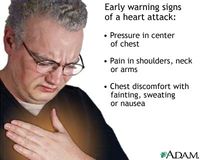 Heart attack symptoms from adam